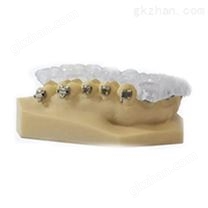 E-DENT 400 透明打印材料